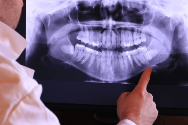 Best Emergency Dentist for Knocked-Out Tooth in USA
